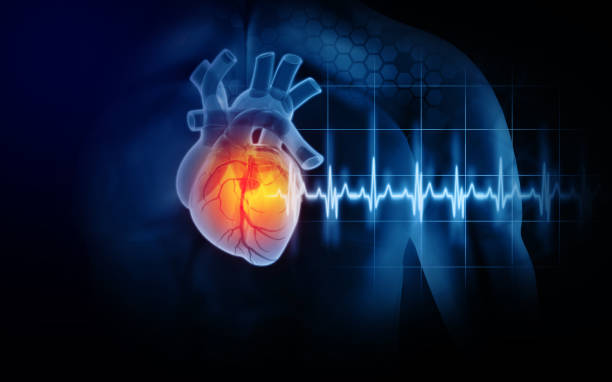 Heart attack and heart disease